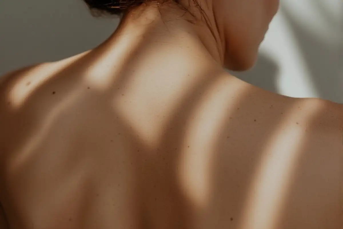 Pickel am Rücken: Ursachen, Behandlung und Tipps gegen Rückenakne